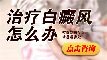 治疗白癜风需要